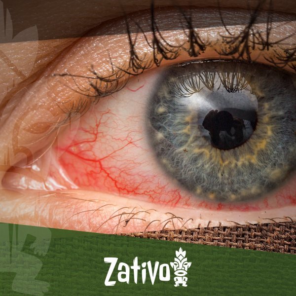 Rode ogen en cannabis: Hoe komt het en wat doe je - Zativo
